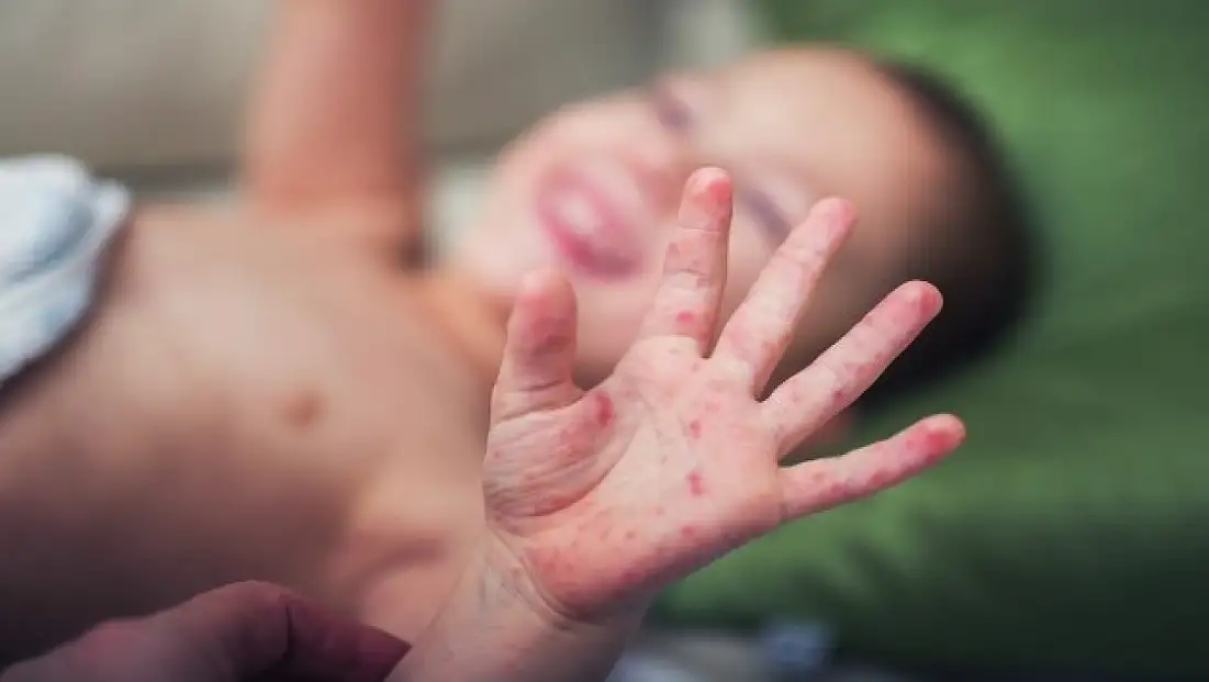 Çocuklarda sessiz ilerleyen kulak hastalığına dikkat