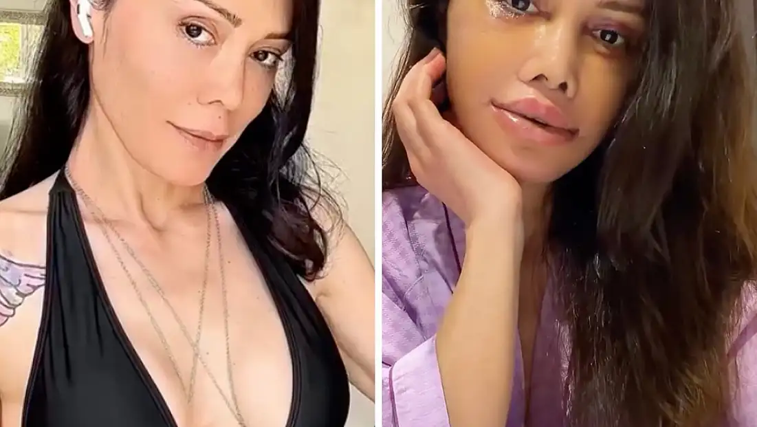 Didem Ceran Neden Yüz Nakli Oldu mu Gerçek mi Doğru mu?