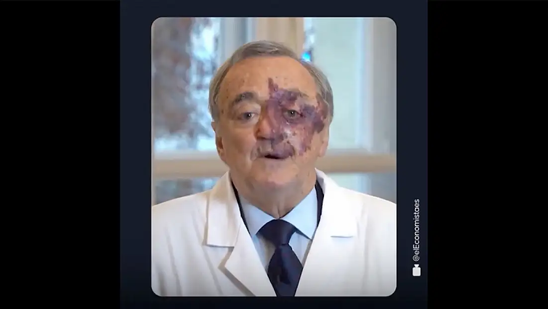 Farelerde kanseri yok eden tedavi insanlara ne zaman uygulanacak?