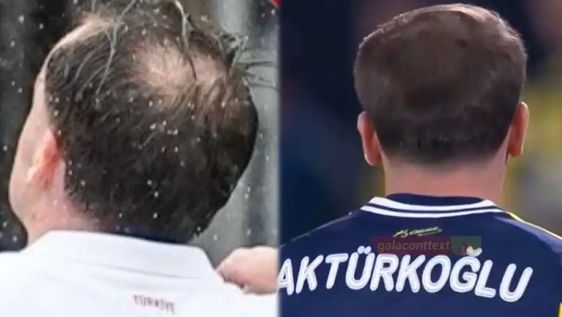 Kerem Aktürkoğlu Saç mı Ektirdi? Saçına Ne Yaptı? İşte Son Hali ve Merak Edilen Detaylar