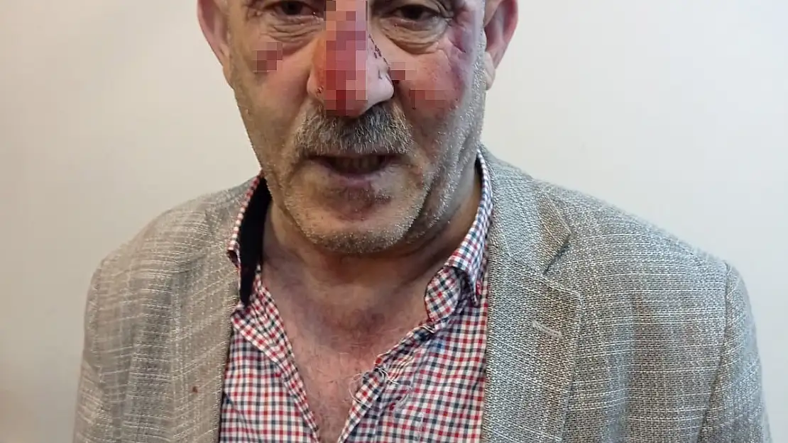Ağrı'da hastane personeline şiddet
