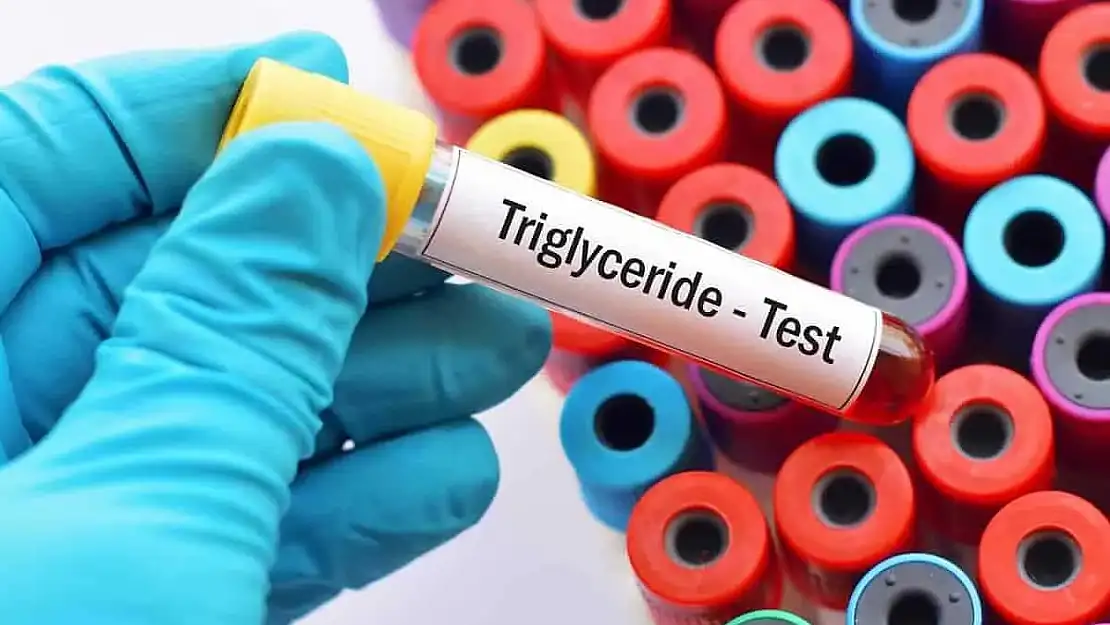 Trigliserid nedir, nasıl düşürülür?