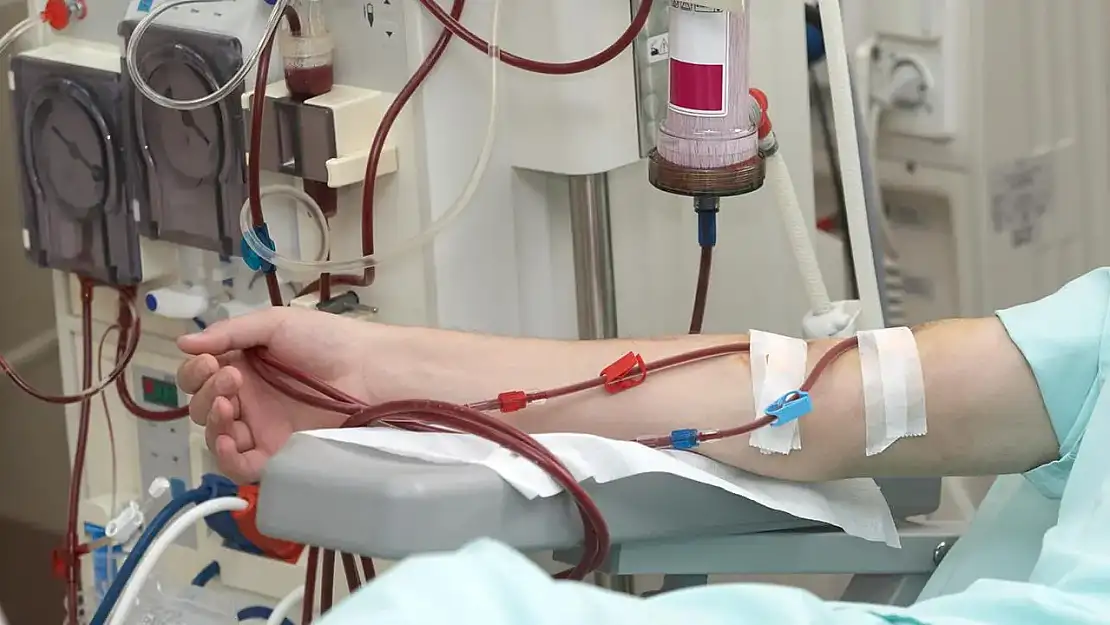 Kimler Evde Diyaliz Hizmeti Alabilir? Şartları