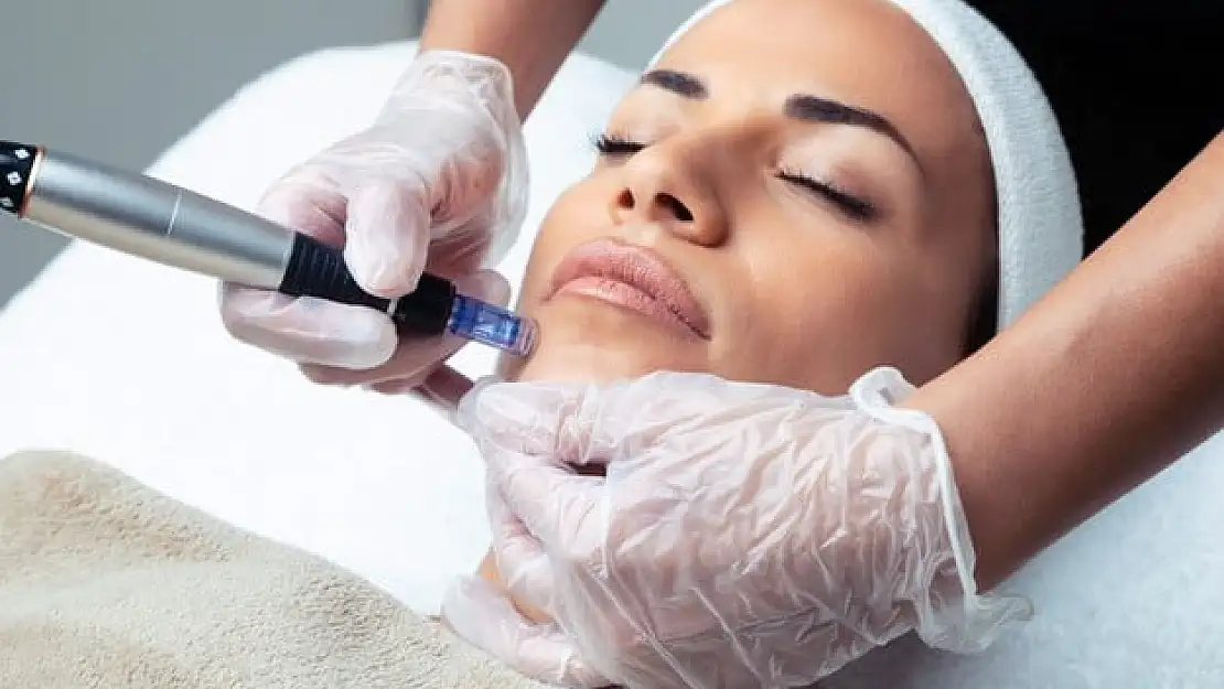 Dermapen uygulaması nedir, nasıl uygulanır?