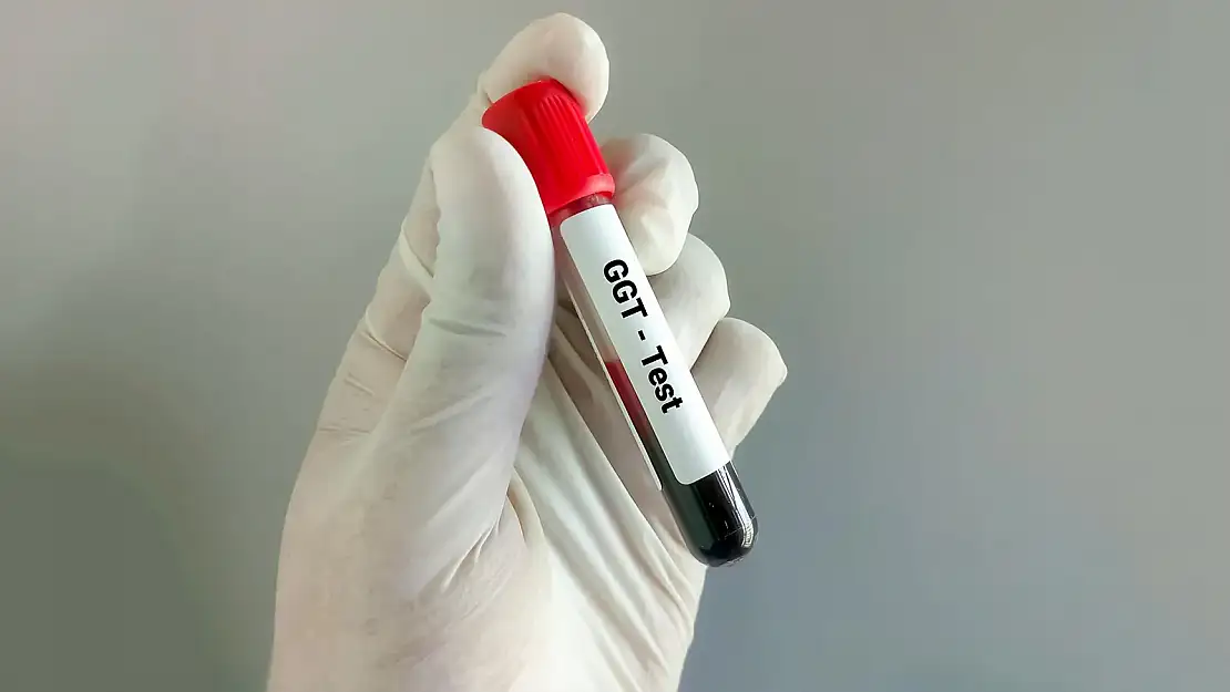 Gama Glutamil Transferaz (GGT) Testi Nedir? .