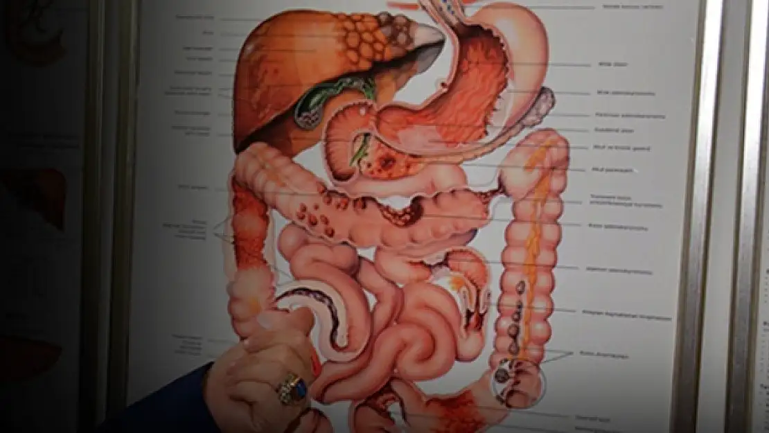 Hemoroid (Basur) nedir? Nasıl Çıkar ?Hemoroid nasıl geçer? Basur tedavi yöntemleri neler?