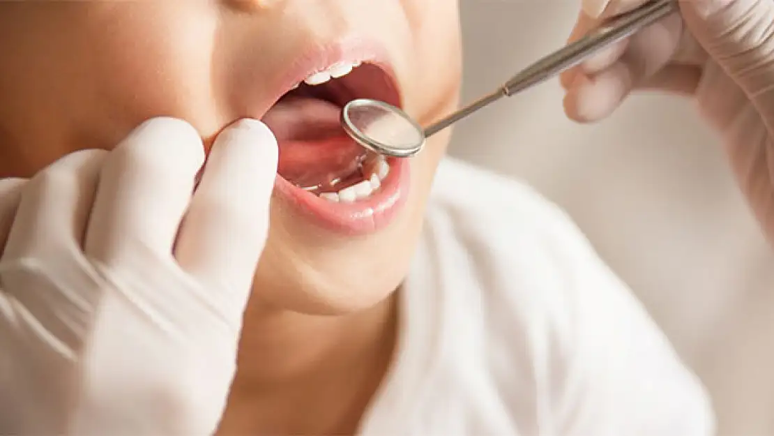 Diş eti hastalığı olanlar dikkat: Akciğer sağlığınız tehlikede olabilir