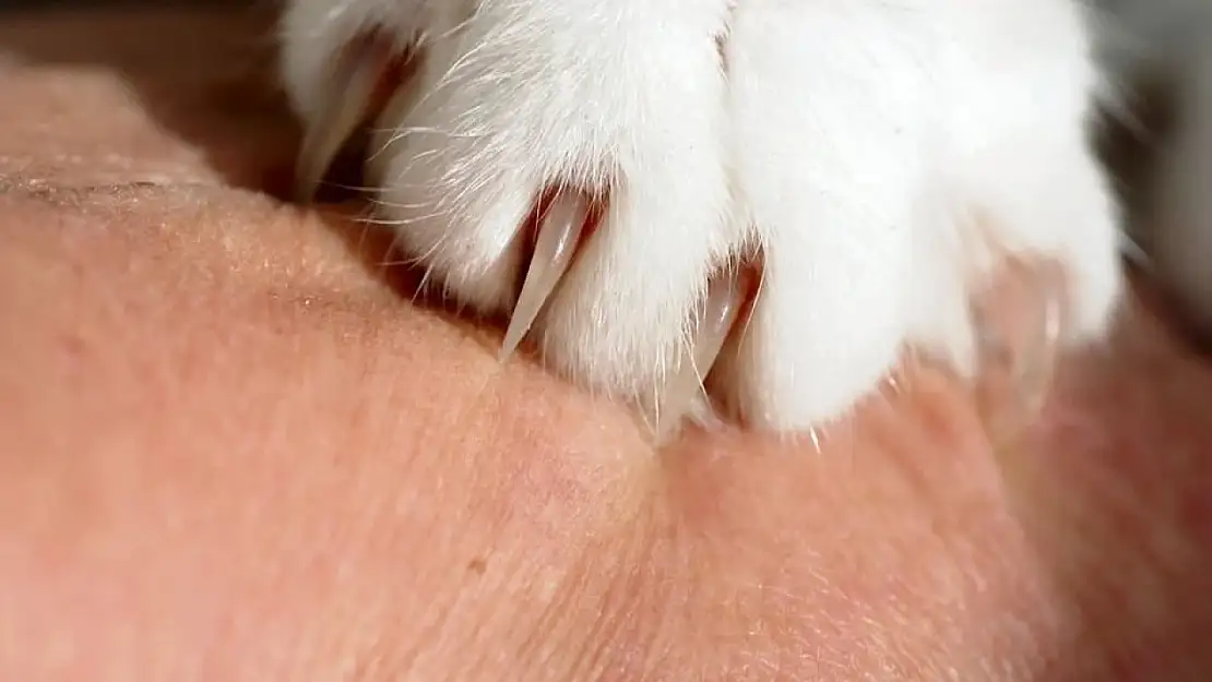 Kedi tırmalaması göz enfeksiyonlarına yol açabilir