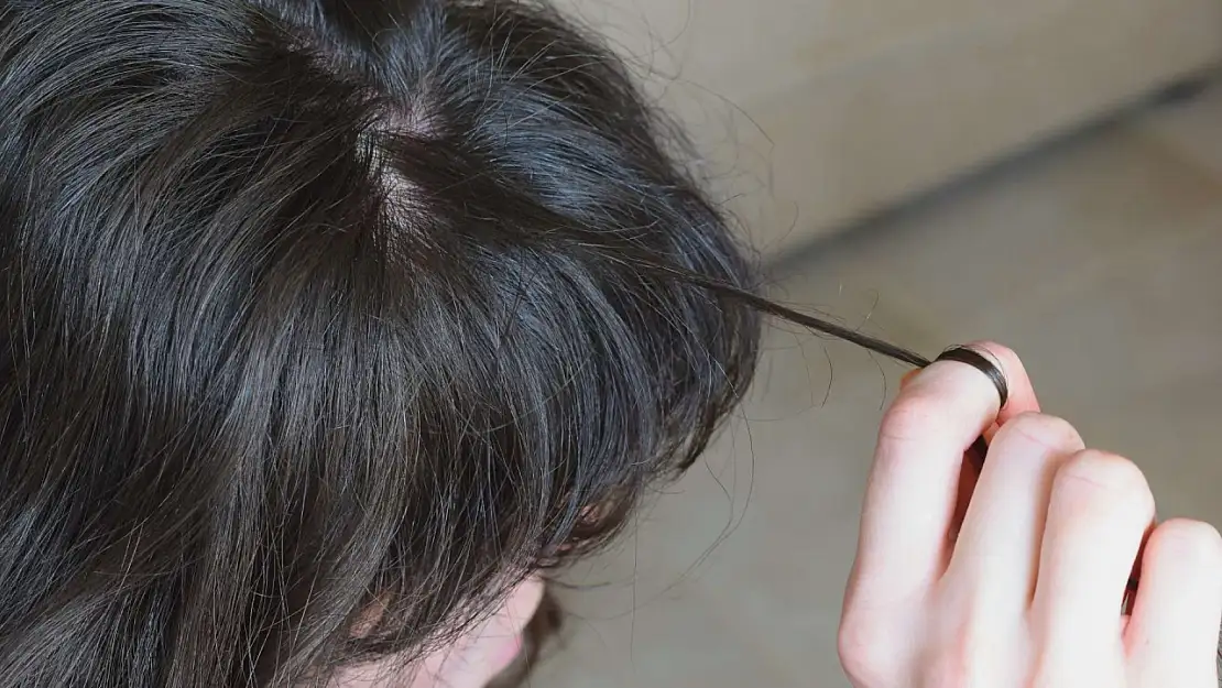 Trikotillomani Hastalığı Nedir? Saç Koparma Alışkanlığı Neden Olur ve Nasıl Geçer?