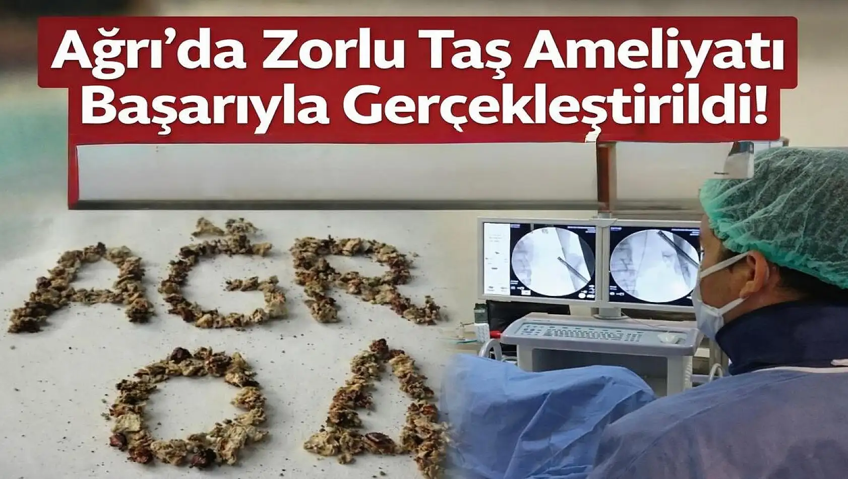 21 kez ameliyat olmuştu: Zorlu taş cerrahisi Ağrı'da başarıyla yapıldı