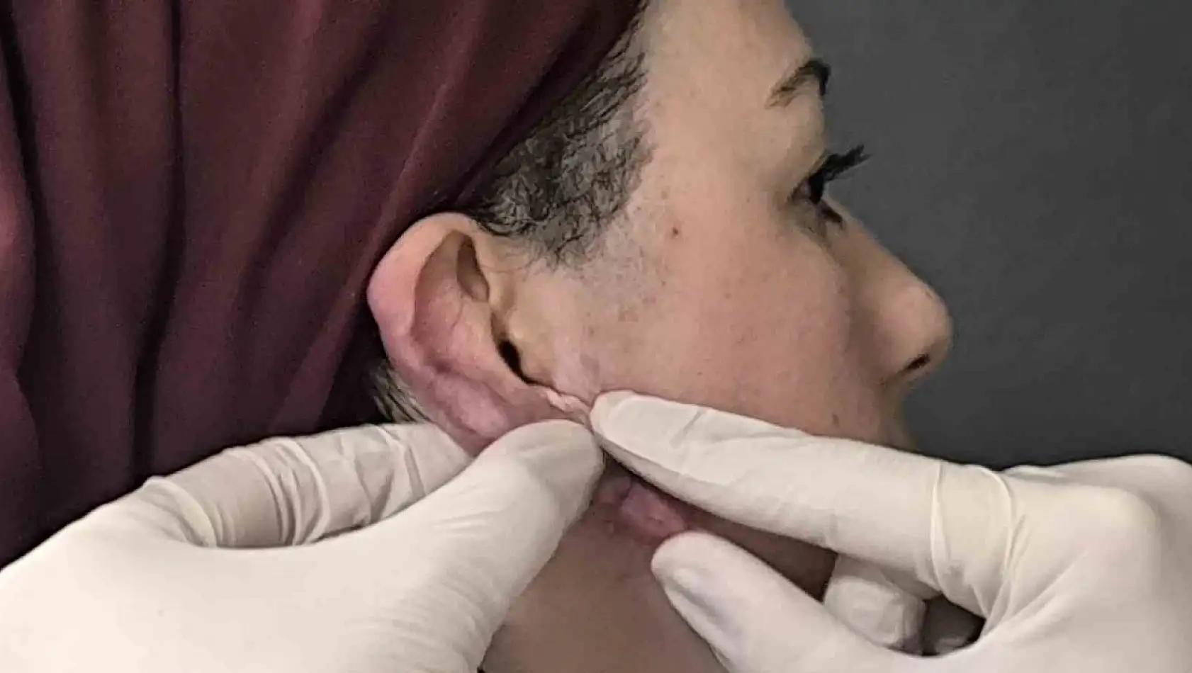 Çocuklukta yapılan hata, ödüllü yöntemle düzeltildi