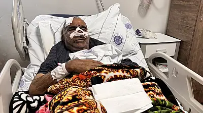 Ağrı'da yaşanan ayı saldırısının perde arkası: Doktorlar neler söyledi?