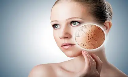 Cilt kuruluğu sadece soğuk havadan kaynaklanmayabilir