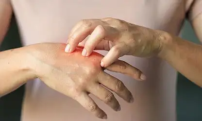 Soğuk hava cildi zorluyor: Kuruluk ve egzama şikâyetleri yükseldi