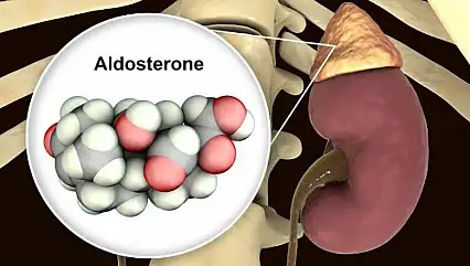 Bu iki belirti birlikte görülüyorsa dikkat: Nedeni aldosteron hormonu olabilir