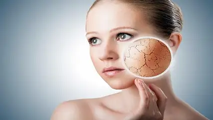 Cilt kuruluğu sadece soğuk havadan kaynaklanmayabilir