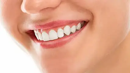 Estetik bir gülüşün sırrı sağlıklı diş etlerinde