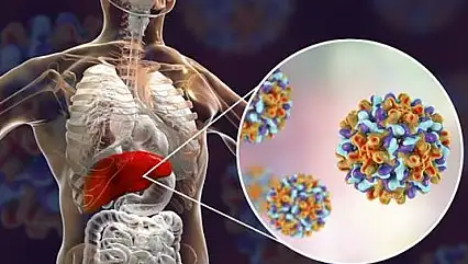 Hepatitte doğru sanılan yanlışlar tedaviyi geciktiriyor