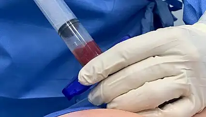 Kök hücre naklinde doğru donör seçimi hayati önem taşıyor