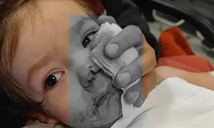 Etimesgut'ta pitbull saldırısı: Köpek sahibi tutuklandı, çocuklar hastaneye kaldırıldı