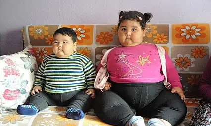 Obez çocuk sayısı dünyada ilk kez zayıf çocukları geçti