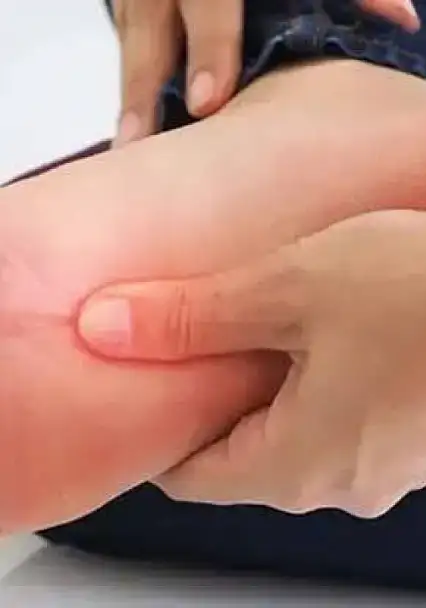Yanlış terlik kullanımı ayak sağlığını tehdit ediyor