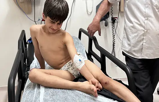 Erzurum'da sahipli köpek 10 yaşındaki çocuğa saldırdı
