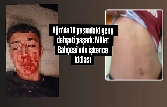 Ağrı'da 16 yaşındaki genç dehşeti yaşadı: Millet Bahçesi'nde işkence iddiası
