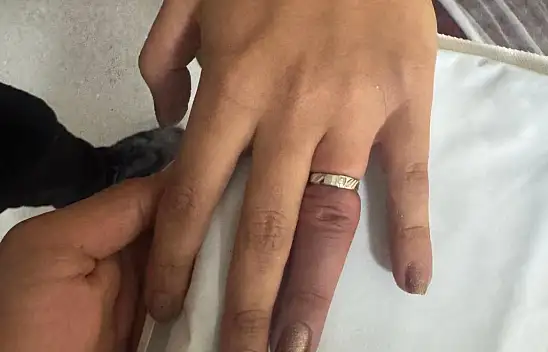 Ağrı'da parmağına sıkışan yüzük için ekipler seferber oldu