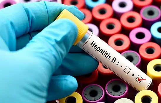 Hepatit B her yıl 1 milyon can alıyor