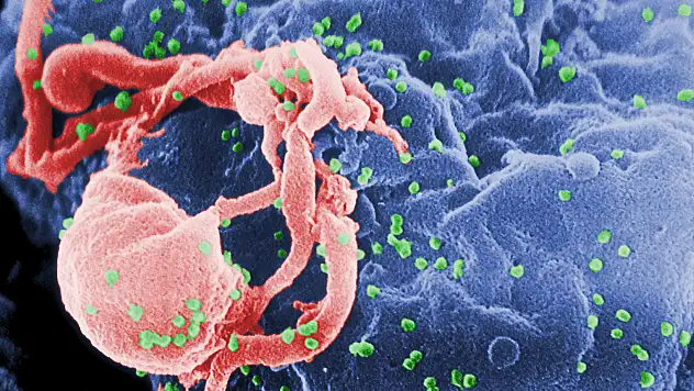 HIV nedir, neden olur? Tedavisi var mı?