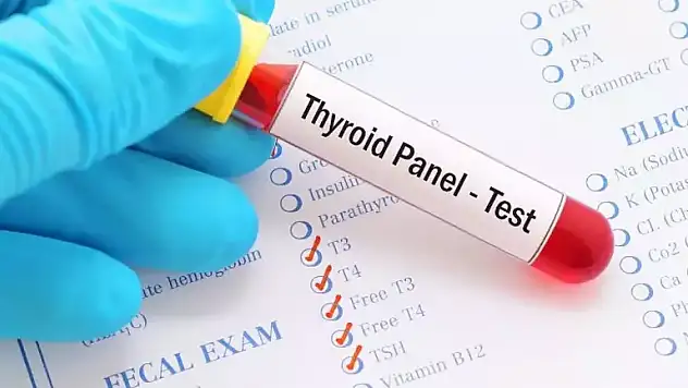 Serbest T4 Nedir?