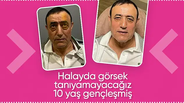 Mamudo Gurban Ne Yaptın Sen Öyle?