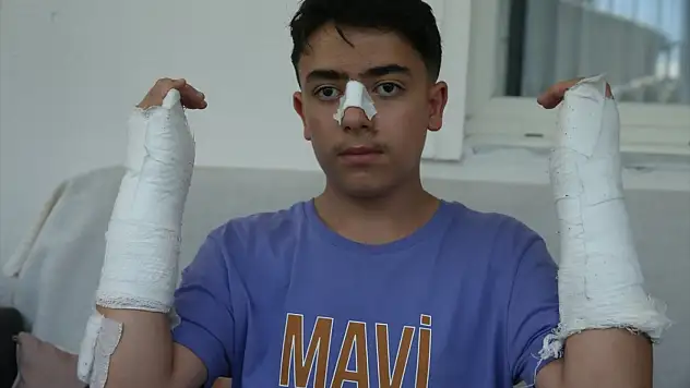 Kars'ta sahipsiz köpek 13 yaşındaki çocuğa saldırdı