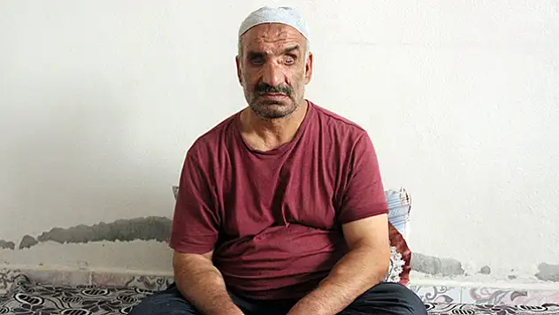Geçirdiği kaza hayatını karanlığa çevirdi