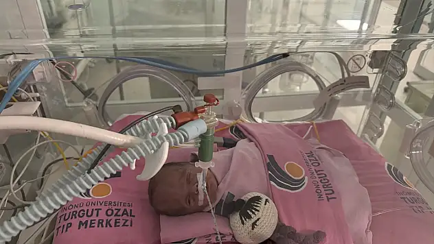 Ağrı'da 25 haftalık doğan Ayaz bebek Malatya'da hayata tutunmaya çalışıyor
