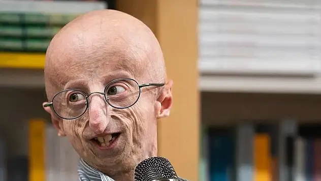 Benjamin Button Gerçek mi?