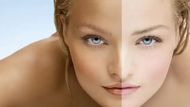 Bronzlaşma Ne Demek? Sağlıklı Bronzlaşma Yolları