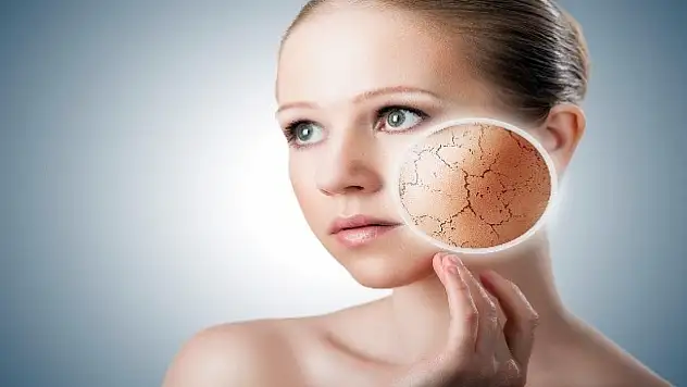 Cilt kuruluğu sadece soğuk havadan kaynaklanmayabilir