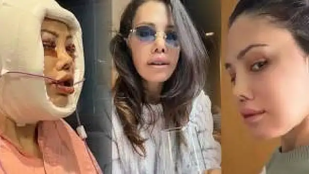 Didem Ceran Hastalığı Nedir?