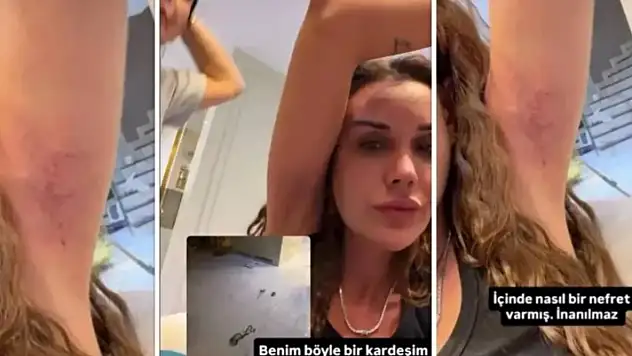 Dilan Polat Sıla Doğu'yu Neden Dövdü? Sıla Doğu Dilan Polat Kavgası Olayı Nedir?