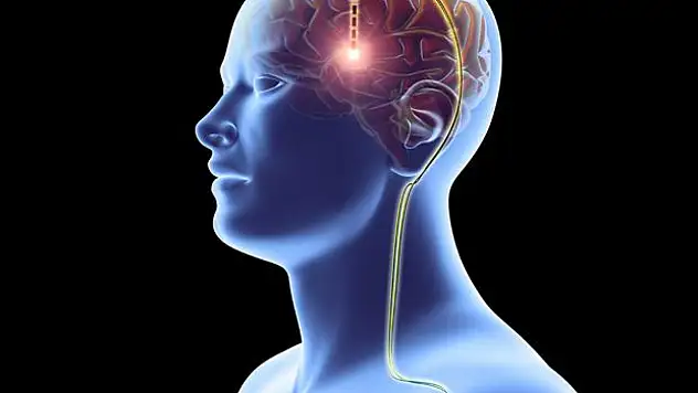 Parkinson'da umut veren yöntem: 'Beyin Pili' ile hareket kabiliyeti artabiliyor