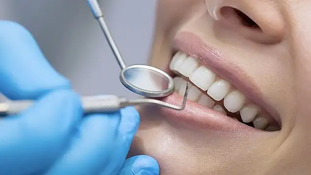 Restoratif Diş Tedavisi Nedir?