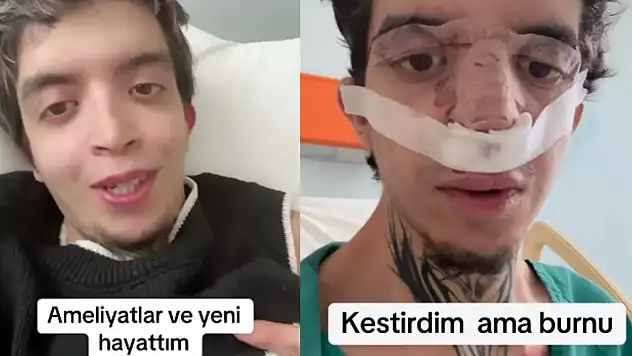 Tablet Reis kimdir, yeni estetik mi yaptırdı?