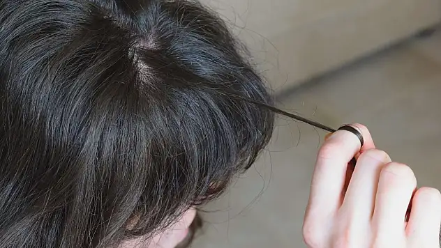 Trikotillomani Hastalığı Nedir? Saç Koparma Alışkanlığı Neden Olur ve Nasıl Geçer?