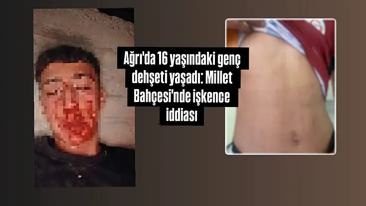 Ağrı'da 16 yaşındaki genç dehşeti yaşadı: Millet Bahçesi'nde işkence iddiası