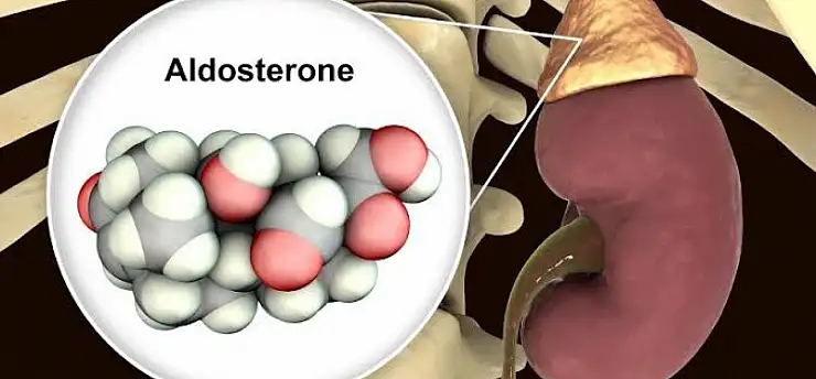 Bu iki belirti birlikte görülüyorsa dikkat: Nedeni aldosteron hormonu olabilir