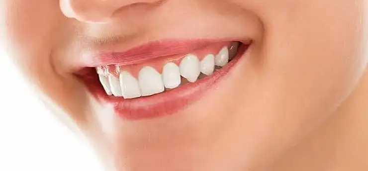 Estetik bir gülüşün sırrı sağlıklı diş etlerinde