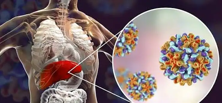 Hepatitte doğru sanılan yanlışlar tedaviyi geciktiriyor