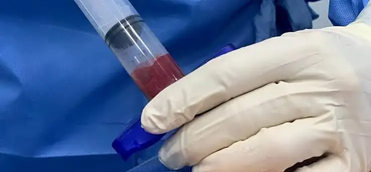 Kök hücre naklinde doğru donör seçimi hayati önem taşıyor